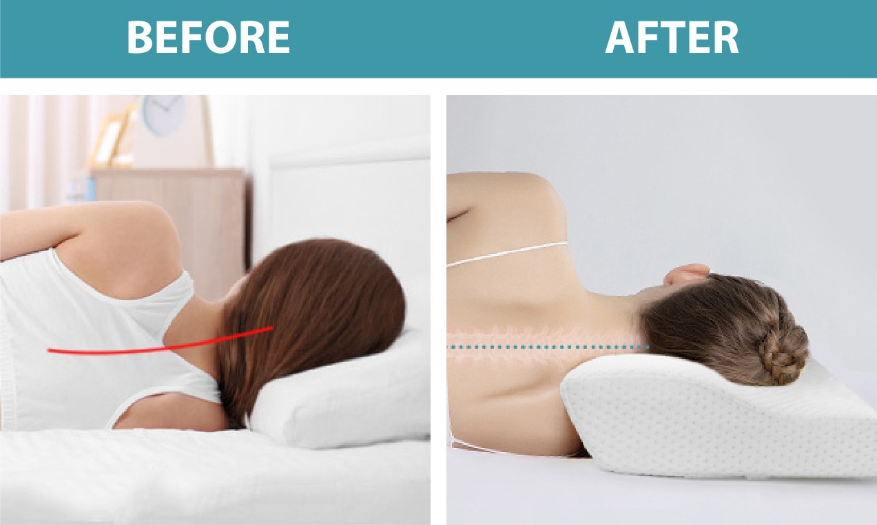 Orthopedic neck clearance pillow